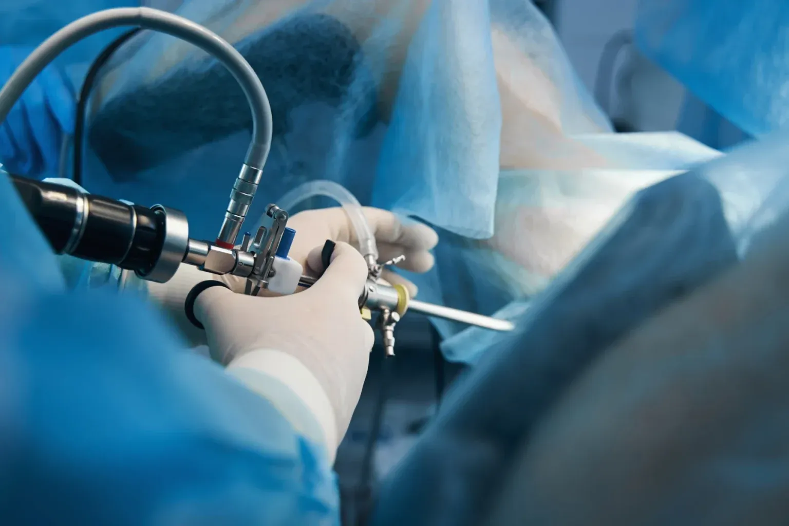 Endoscopie et cœlioscopie – gynécologue à Marrakech